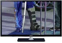 Mark Winterbottom talks about his broken ankle Mark Winterbottom talks about his broken ankle