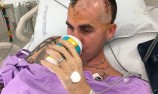 Mingay undergoes successful brain surgery